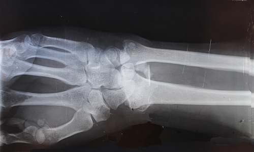 ct scan x-ray result grey